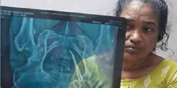 വണ്ടാനത്ത് അമ്മയെ കാണിച്ചതാണ് ഞങ്ങളുടെ തെറ്റ്, അത്രയധികം അനുഭവിച്ചു, ഞങ്ങൾ കത്രിക വിഴുങ്ങിയത് പോലെയാണ് അന്വേഷണ റിപ്പോര്‍ട്ട്, എല്ലാവരും കയ്യൊഴിഞ്ഞു, നീതിക്കായി ഏതറ്റം വരെയും പോകുമെന്ന് ഉഷയുടെ മകന്‍