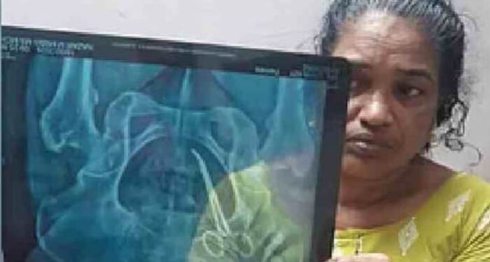 വണ്ടാനത്ത് അമ്മയെ കാണിച്ചതാണ് ഞങ്ങളുടെ തെറ്റ്, അത്രയധികം അനുഭവിച്ചു, ഞങ്ങൾ കത്രിക വിഴുങ്ങിയത് പോലെയാണ് അന്വേഷണ റിപ്പോര്‍ട്ട്, എല്ലാവരും കയ്യൊഴിഞ്ഞു, നീതിക്കായി ഏതറ്റം വരെയും പോകുമെന്ന് ഉഷയുടെ മകന്‍