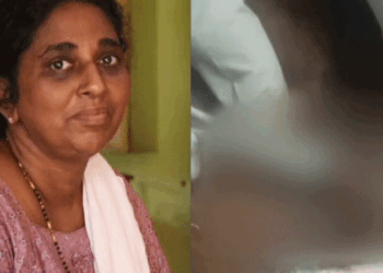 വീണ്ടും ചികിത്സാപ്പിഴവ്; അപ്പൻഡിസൈറ്റിസ് ശസ്ത്രക്രിയക്കിടെ തുണിക്കഷ്ണം വയറ്റിനുള്ളിൽ വച്ച് തുന്നിക്കെട്ടി, സ്വകാര്യ ആശുപത്രിക്കെതിരെ പരാതി