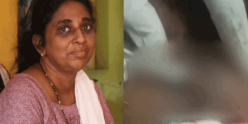 വീണ്ടും ചികിത്സാപ്പിഴവ്; അപ്പൻഡിസൈറ്റിസ് ശസ്ത്രക്രിയക്കിടെ തുണിക്കഷ്ണം വയറ്റിനുള്ളിൽ വച്ച് തുന്നിക്കെട്ടി, സ്വകാര്യ ആശുപത്രിക്കെതിരെ പരാതി