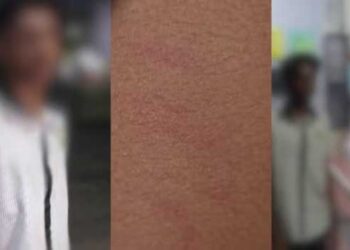 മുടി വെട്ടിയതും പുതിയ ചെരിപ്പിട്ടതും സീനിയർ വിദ്യാർഥികൾക്ക് പിടിച്ചില്ല!! ഒമ്പതാംക്ലാസ് വിദ്യാർഥികൾ ചേർന്ന് പരീക്ഷ കഴിഞ്ഞിറങ്ങിയ എട്ടാംകാസുകാരനെ സ്കൂളിനു പിന്നിലേക്ക് പിടിച്ചുകൊണ്ടുപോയി വളഞ്ഞിട്ട് മർദിച്ചു, സ്കൂൾ ബസിൽ കയറാൻ പോലും അനുവദിച്ചില്ല, കുട്ടി സ്വകാര്യ ആശുപത്രിയിൽ ചികിത്സയിൽ,