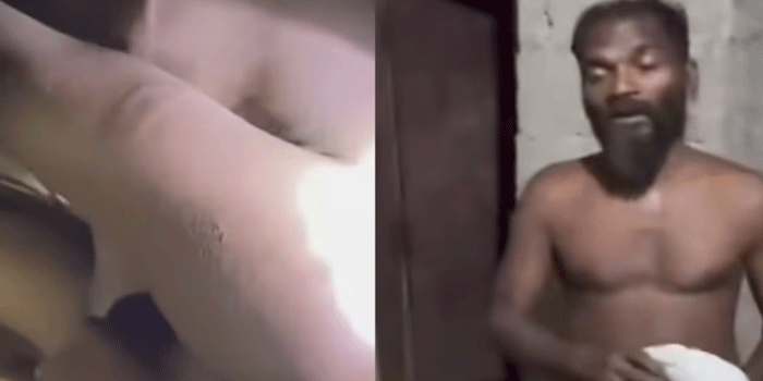 കോടാലി കൈകൊണ്ട് പതിമൂന്നുകാരന് ക്രൂര മർദ്ദനം; പിതാവ് അറസ്റ്റിൽ; കുട്ടിയുടെ കാലിലും കൈയ്ക്കും പുറത്തുമെല്ലാം ഗുരുതര പരിക്ക്