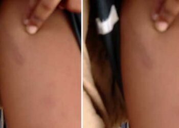 6 വയസുകാരന്റെ മുഖത്തിന്റെ ഒരു വശത്ത് തണുത്ത പാൽക്കവർ വെച്ച ശേഷം മറുഭാഗത്തെ കവിളിൽ ആഞ്ഞടിച്ചു, കാലുകൾ വളച്ചൊടിച്ച് കഴുത്തോളം വലിച്ചുനീട്ടി, കഴുത്ത് നിലത്തേക്ക് അമർത്തിപ്പിടിച്ചു…  കുട്ടി കരയുമ്പോൾ, ശബ്ദം പുറത്തുവരാതിരിക്കാൻ വായിൽ തുണി തിരുകിയ ശേഷം വീണ്ടും മർദ്ദനം, ഉറങ്ങി കിടക്കുമ്പോൾ പോലും കുട്ടിയെ മർദിച്ചു… രണ്ടാനച്ഛന്റെ കയ്യിൽ നിന്ന് കുരുന്ന് നേരിട്ടത് സമാനതകളില്ലാത്ത കൊടീയ പീഡനം