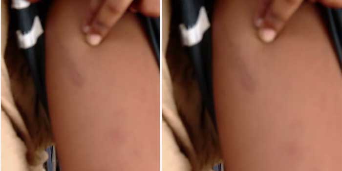 6 വയസുകാരന്റെ മുഖത്തിന്റെ ഒരു വശത്ത് തണുത്ത പാൽക്കവർ വെച്ച ശേഷം മറുഭാഗത്തെ കവിളിൽ ആഞ്ഞടിച്ചു, കാലുകൾ വളച്ചൊടിച്ച് കഴുത്തോളം വലിച്ചുനീട്ടി, കഴുത്ത് നിലത്തേക്ക് അമർത്തിപ്പിടിച്ചു…  കുട്ടി കരയുമ്പോൾ, ശബ്ദം പുറത്തുവരാതിരിക്കാൻ വായിൽ തുണി തിരുകിയ ശേഷം വീണ്ടും മർദ്ദനം, ഉറങ്ങി കിടക്കുമ്പോൾ പോലും കുട്ടിയെ മർദിച്ചു… രണ്ടാനച്ഛന്റെ കയ്യിൽ നിന്ന് കുരുന്ന് നേരിട്ടത് സമാനതകളില്ലാത്ത കൊടീയ പീഡനം