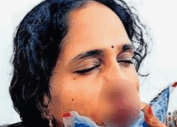 ക്ലാസിനിടെ ​ഗെയിം കളിക്കരുതെന്ന് പറഞ്ഞു; വിദ്യാർത്ഥി അധ്യാപികയെ ആക്രമിച്ചു; ​ഗുരുതര പരിക്ക്; മൂക്കിന്റെ എല്ല് തകർന്നു