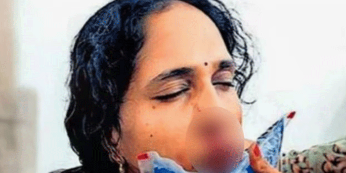 ക്ലാസിനിടെ ​ഗെയിം കളിക്കരുതെന്ന് പറഞ്ഞു; വിദ്യാർത്ഥി അധ്യാപികയെ ആക്രമിച്ചു; ​ഗുരുതര പരിക്ക്; മൂക്കിന്റെ എല്ല് തകർന്നു