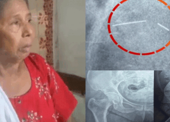 ‘ശരീരത്തിൽ പകുതി സൂചി കുടുങ്ങിയ നിലയിലാണ് വത്സലയെ ഡിസ്ചാർജ്  ചെയ്തെന്നത് ഡോക്ടറുടെ വീഴ്ച; എന്നാൽ അത് കോഴഞ്ചേരി ജില്ല ആശുപത്രിയിൽ നിന്നും കുത്തിവച്ച സൂചിയാണെന്നതിന് തെളിവില്ല‘- ചികിത്സ പിഴവ് പരാതിയിൽ അന്വേഷണ റിപ്പോർട്ട്