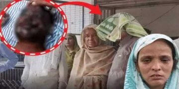 ഭാര്യയുടെ അവിഹിതം ചോദ്യം ചെയ്ത് നിരന്തരം വഴക്ക്, ഉറങ്ങിക്കിടന്ന ഭർത്താവിന്റെ മുഖത്ത് ആസിഡ് ഒഴിച്ചു, അലറിക്കരഞ്ഞ് ഓടി രക്ഷപ്പെടാൻ ശ്രമിക്കുന്നതിനിടെ വീണ്ടും ഒഴിച്ചു!!  യുവാവിന്റെ മുഖം വികൃതമായി, ഇരു കണ്ണുകളുടെയും കാഴ്ച്ച ശക്തി നഷ്ടപ്പെട്ടു!! 30 കാരിക്ക് ജീവപര്യന്തം തടവ് ശിക്ഷ