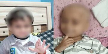 എയിംസിൽ ബ്ലഡ് ക്യാൻസർ രോഗിയായ മൂന്നുവയസുകാരന് മരുന്നിനു പകരം കുത്തിവച്ചത് ബയോപ്സി സാമ്പിളുകളും മൃതദേഹങ്ങളും അഴുകാതിരിക്കാൻ ഉപയോഗിക്കുന്ന ഫോർമാലിൻ, കുത്തിവെക്കാനെടുത്തത് തെറ്റായ മരുന്നാണെന്ന് കുട്ടിയുടെ പിതാവ് ആവർത്തിച്ച് പറഞ്ഞിട്ടും ഗൗനിച്ചില്ല, കുഞ്ഞിന് ദാരുണാന്ത്യം