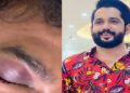 യുവാവിനെ വളഞ്ഞിട്ട് ആക്രമിച്ചു, ഇന്റർ ലോക്ക് കട്ടകൾ ഉപയോ​ഗിച്ച് ക്രൂരമായി മർദിച്ചു, പേനക്കത്തി ഉപയോ​ഗിച്ച് കുത്തി കൊലപ്പെടുത്താൻ ശ്രമം, യുവാവ് ​ഗുരുതരാവസ്ഥയിൽ യുട്യൂബർ ഖാദർ കരിപ്പൊടിക്കും സുഹൃത്തുക്കൾക്കുമെതിരെ വധശ്രമത്തിനു കേസ്, ക്രൂര മർദ്ദനത്തിനു പിന്നിൽ സാമ്പത്തിക ഇടപാട്