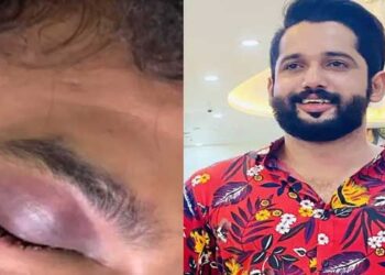 യുവാവിനെ വളഞ്ഞിട്ട് ആക്രമിച്ചു, ഇന്റർ ലോക്ക് കട്ടകൾ ഉപയോ​ഗിച്ച് ക്രൂരമായി മർദിച്ചു, പേനക്കത്തി ഉപയോ​ഗിച്ച് കുത്തി കൊലപ്പെടുത്താൻ ശ്രമം, യുവാവ് ​ഗുരുതരാവസ്ഥയിൽ യുട്യൂബർ ഖാദർ കരിപ്പൊടിക്കും സുഹൃത്തുക്കൾക്കുമെതിരെ വധശ്രമത്തിനു കേസ്, ക്രൂര മർദ്ദനത്തിനു പിന്നിൽ സാമ്പത്തിക ഇടപാട്