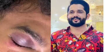 യുവാവിനെ വളഞ്ഞിട്ട് ആക്രമിച്ചു, ഇന്റർ ലോക്ക് കട്ടകൾ ഉപയോ​ഗിച്ച് ക്രൂരമായി മർദിച്ചു, പേനക്കത്തി ഉപയോ​ഗിച്ച് കുത്തി കൊലപ്പെടുത്താൻ ശ്രമം, യുവാവ് ​ഗുരുതരാവസ്ഥയിൽ യുട്യൂബർ ഖാദർ കരിപ്പൊടിക്കും സുഹൃത്തുക്കൾക്കുമെതിരെ വധശ്രമത്തിനു കേസ്, ക്രൂര മർദ്ദനത്തിനു പിന്നിൽ സാമ്പത്തിക ഇടപാട്