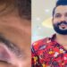 യുവാവിനെ വളഞ്ഞിട്ട് ആക്രമിച്ചു, ഇന്റർ ലോക്ക് കട്ടകൾ ഉപയോ​ഗിച്ച് ക്രൂരമായി മർദിച്ചു, പേനക്കത്തി ഉപയോ​ഗിച്ച് കുത്തി കൊലപ്പെടുത്താൻ ശ്രമം, യുവാവ് ​ഗുരുതരാവസ്ഥയിൽ യുട്യൂബർ ഖാദർ കരിപ്പൊടിക്കും സുഹൃത്തുക്കൾക്കുമെതിരെ വധശ്രമത്തിനു കേസ്, ക്രൂര മർദ്ദനത്തിനു പിന്നിൽ സാമ്പത്തിക ഇടപാട്