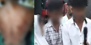 സ്നേഹത്തണല്‍ വൃദ്ധസദനത്തില്‍ മറ്റൊരു കുട്ടിയും ക്രൂര മര്‍ദനത്തിനിരയായി, 17 കാരന്റെ കാലിലും കയ്യിലും പരിക്കേറ്റ പാടുകള്‍, ബാലവേല ചെയ്യിപ്പിച്ചതായും വിവരം