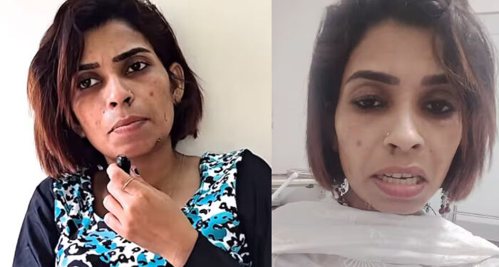 ദയവുചെയ്ത് തന്റെ പേരിൽ ആരും പണം പിരിക്കരുത്, സഹായിക്കാൻ താല്പര്യമുള്ളവർ മാനേജർ കരിഷ്മയെ ബന്ധപ്പെടാം, ഇപ്പോൾ ജോലി ചെയ്യാൻ സാധിക്കാത്ത സാഹചര്യമാണ്, രോഗബാധ മറ്റ് ശരീര ഭാഗങ്ങളിലേക്കും വ്യാപിച്ചു, എല്ലാവരും എന്റെ യുട്യൂബ് വീഡിയോ കണ്ട് സഹായിക്കണം- രേണു സുധി