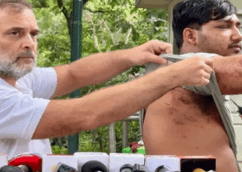‘പ്രധാൻ ക്രിമിനൽ മന്ത്രി;ദേശീയ പതാകയേന്തി പ്രതിഷേധത്തിൽ പങ്കെടുത്ത 9-കാരനാണ് ഈ ​ഗതി; യുവാവിന്റെ കാഴ്ച തിരിച്ചുകിട്ടുമോയെന്ന കാര്യത്തിൽ ഡോക്ടർമാർക്കും വ്യക്തതയില്ല ’; പെല്ലറ്റ് ആക്രമണത്തിൽ പ്രതികരിച്ച് രാഹുൽ ​ഗാന്ധി