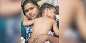 കുട്ടിയുടെ മലദ്വാരത്തിന് ഗുരുതര പരുക്ക്, കയ്യിലും നെഞ്ചിലുമടക്കം 25 മുറിവുകൾ… വീടിനു മുറ്റത്ത് കളിച്ചുകൊണ്ടിരുന്ന ഒന്നര വയസുകാരനെ തെരുവുനായകൾ കൂട്ടത്തോടെ ആക്രമിച്ചു, കടിയേറ്റ് കുട്ടി പിടഞ്ഞുവീണത് സമീപത്തെ ഓടയിലേക്ക്