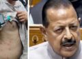 “അതിന് ആരു വെടിവച്ചു?, പോലീസ് ടിയർ ഗ്യാസാണ് പ്രയോഗിച്ചത്… അപ്പോൾ പിന്നെ ആരാണ് വെടിവെക്കാൻ ഉത്തരവ് നൽകിയത് എന്ന ചോദ്യത്തിന് എന്തു പ്രസക്തി”?- ജിതേന്ദ്ര സിങ്!! വിദ്യാർഥികൾക്ക് നേരെ വെടിയുതിർക്കാൻ ഉത്തരവിട്ടത് ആഭ്യന്തരമന്ത്രിയാണെന്ന രാഹുൽ ​ഗാന്ധിയുടെ ആരോപണത്തിൽ തെളിവ് ആവശ്യപ്പെട്ട് ബിജെപി