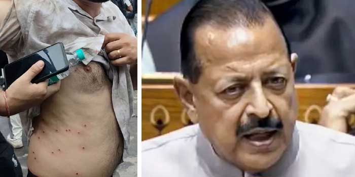 “അതിന് ആരു വെടിവച്ചു?, പോലീസ് ടിയർ ഗ്യാസാണ് പ്രയോഗിച്ചത്… അപ്പോൾ പിന്നെ ആരാണ് വെടിവെക്കാൻ ഉത്തരവ് നൽകിയത് എന്ന ചോദ്യത്തിന് എന്തു പ്രസക്തി”?- ജിതേന്ദ്ര സിങ്!! വിദ്യാർഥികൾക്ക് നേരെ വെടിയുതിർക്കാൻ ഉത്തരവിട്ടത് ആഭ്യന്തരമന്ത്രിയാണെന്ന രാഹുൽ ​ഗാന്ധിയുടെ ആരോപണത്തിൽ തെളിവ് ആവശ്യപ്പെട്ട് ബിജെപി
