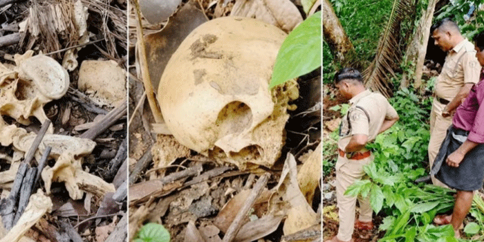 കോഴിക്കോട് പേരാമ്പ്രയ്ക്ക് സമീപം പറമ്പിൽ മനുഷ്യ അസ്ഥികൂടത്തിന്റെ അവശിഷ്ടങ്ങൾ; തലയോട്ടിയും മറ്റ് അസ്ഥികളും വ്യത്യസ്ത സ്ഥലങ്ങളിലായി ചിതറിക്കിടന്ന നിലയിൽ; ഒരു മാസത്തിലേറെ പഴക്കമുണ്ട്; കാണാതായ വയോധികന്റേതെന്ന് സംശയം