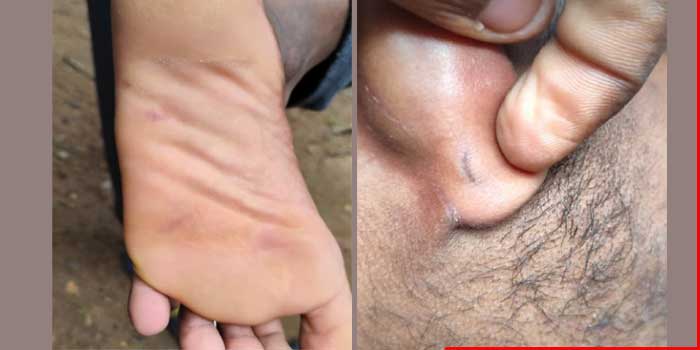 13കാരിയെ തനിക്ക് അറിയില്ലെന്ന് പറഞ്ഞിട്ട് കേട്ടില്ല, തന്റെ കാലിനടിയിൽ ലാത്തികൊണ്ട് മർദിച്ചു, ബൂട്ടിട്ട കാലുകൊണ്ട് കാൽ ചവിട്ടിയരച്ചു, രണ്ടു ചെവിയിലുമായി പിടിച്ച് പൊക്കി, ഹൃദയ ശസ്ത്രക്രിയ കഴിഞ്ഞ ആളാണെന്ന് പറഞ്ഞിട്ടും മുഖവിലയ്ക്കെടുത്തില്ല- ആഭ്യന്തമന്ത്രിക്ക് പരാതി നൽകി 20 കാരൻ