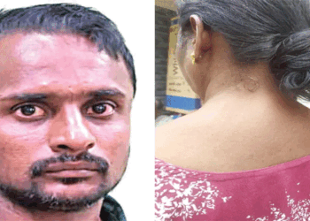 63 കാരിയുടെ കഴുത്തിൽ കുത്തിപ്പിടിച്ച് സ്വർണമാല കവർന്നു; നടന്നു പോകവെ പിന്നാലെയെത്തി ആക്രമിക്കുകയായിരുന്നു, ഓടിരക്ഷപ്പെടാൻ ശ്രമിച്ച മോഷ്ടാവിനെ നാട്ടുകാർ പിന്തുടർന്ന് പിടികൂടി