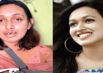 ‘ശരീരം മുഴുവൻ എല്ലുനുറുങ്ങും വേദനയാണ്; കണ്ണടയ്ക്കുമ്പോൾ പേടി ഇരച്ചെത്തും; ആഹാരം കഴിക്കാൻ കഴിയുന്നില്ല; കണ്ണാടിയിൽ നോക്കുമ്പോൾ ഞാനറിയുന്ന ഞാനല്ല മുന്നിൽ…’; റാപ്പിഡോ അപകടത്തിൽ തകർന്ന സാനി കൃഷ്ണ