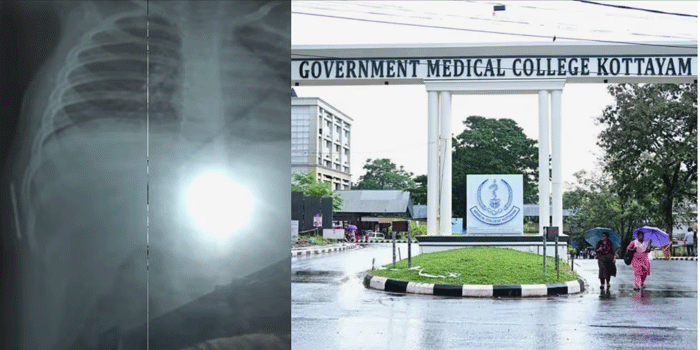 ‘അങ്ങനെയൊരു സംഭവമേ നടന്നിട്ടില്ല’: ഒരു വയസുകാരന്റെ ശരീരത്തിൽ സൂചി കണ്ടെത്തിയ സംഭവം; കോട്ടയം മെഡിക്കൽ കോളേജിന് വീഴ്ചയില്ലെന്ന് അന്വേഷണ റിപ്പോർട്ട്; മുഖ്യമന്ത്രിക്ക് പരാതി നല്കാനൊരുങ്ങി കുടുംബം