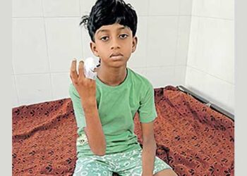 ‘ചേട്ടാ, പട്ടി വരുന്നു… ഓടിക്കോയെന്ന് വിളിച്ചുപറഞ്ഞ് അനിയൻ ഓടി, പക്ഷെ പേടിച്ചിട്ട് എനിക്ക് ഒരടി പോലും അനങ്ങായില്ല… ചാടി വീണ് ഇടതുതുടയിൽ കടിച്ചു, കരച്ചിൽ കേട്ടെത്തിയ അമ്മാവൻ നായയെ കല്ലെറിഞ്ഞ് ഓടിച്ചു, അൽപദൂരം പോയി വീണ്ടുമെത്തി എന്റെ മോതിര വിരൽ കടിച്ചെടുത്തു…