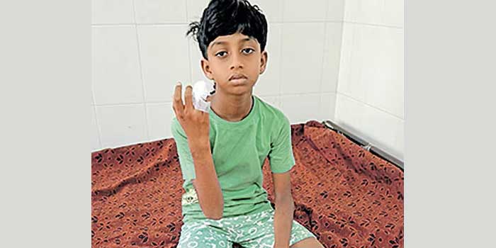 ‘ചേട്ടാ, പട്ടി വരുന്നു… ഓടിക്കോയെന്ന് വിളിച്ചുപറഞ്ഞ് അനിയൻ ഓടി, പക്ഷെ പേടിച്ചിട്ട് എനിക്ക് ഒരടി പോലും അനങ്ങായില്ല… ചാടി വീണ് ഇടതുതുടയിൽ കടിച്ചു, കരച്ചിൽ കേട്ടെത്തിയ അമ്മാവൻ നായയെ കല്ലെറിഞ്ഞ് ഓടിച്ചു, അൽപദൂരം പോയി വീണ്ടുമെത്തി എന്റെ മോതിര വിരൽ കടിച്ചെടുത്തു…