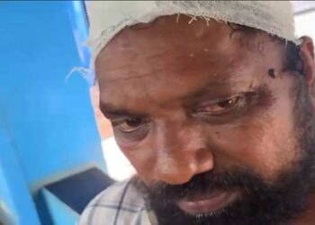 സ്വന്തം വീട്ടിലിരുന്ന് ചുമച്ചത് അയൽവാസിക്ക് പിടിച്ചില്ല, വീട്ടിൽ കയറി കഴുത്തിനുപിടിച്ച് പുറത്തേക്ക് വലിച്ചിറക്കി യുവാവ് ക്രൂരമായി മർദിച്ചതായി പരാതി, മർദനത്തിൽ പരുക്കേറ്റ 58ന്റെ തലയിൽ സ്റ്റിച്ചിട്ടു, കേസെടുത്ത് പോലീസ്