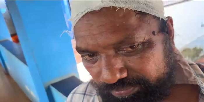 സ്വന്തം വീട്ടിലിരുന്ന് ചുമച്ചത് അയൽവാസിക്ക് പിടിച്ചില്ല, വീട്ടിൽ കയറി കഴുത്തിനുപിടിച്ച് പുറത്തേക്ക് വലിച്ചിറക്കി യുവാവ് ക്രൂരമായി മർദിച്ചതായി പരാതി, മർദനത്തിൽ പരുക്കേറ്റ 58ന്റെ തലയിൽ സ്റ്റിച്ചിട്ടു, കേസെടുത്ത് പോലീസ്
