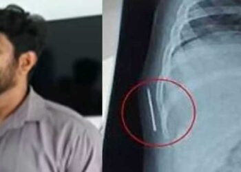 തടിതപ്പാൻ നോക്കണ്ട, ഒരു വയസുകാരിയുടെ ശരീരത്തിൽ കുടുങ്ങിയത് സൂചിതന്നെ, പ്രസവ സമയത്താണ് സൂചി ശരീരത്തിൽ തറച്ചത്… കുറ്റക്കാർക്കെതിരെ കർശന നടപടി വേണം- അന്വേഷണ റിപ്പോർട്ടിനെതിരെ കുട്ടിയുടെ പിതാവ്