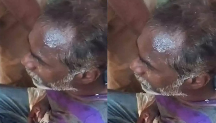 ഓണം ബമ്പർ അടിച്ചില്ല………. ലോട്ടറി വിൽപ്പനക്കാരിയെ കുത്തി പരിക്കേല്പ്പിച്ചു