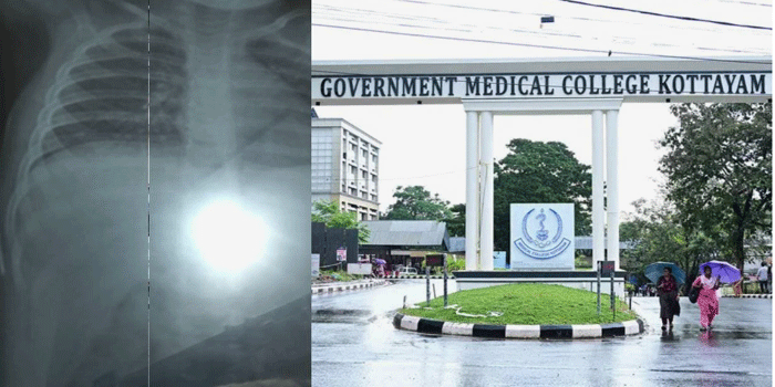 ചികിത്സയ്ക്കിടെ കുഞ്ഞിന്റെ ശരീരത്തിൽ സൂചി കണ്ടെത്തിയെന്ന പരാതി;കോട്ടയം മെഡിക്കൽ കോളേജിനെതിരെ പൊലീസ് കേസ്