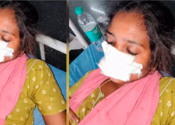 ഭര്‍ത്താവിനോട് വഴക്കിട്ട് സ്വന്തം വീട്ടിലേക്ക് പോയി, എത്ര വിളിച്ചിട്ടും തിരിച്ചു വന്നില്ല, ദേഷ്യം സഹിക്കാനാകാതെ ഭാര്യയുടെ മൂക്ക് കടിച്ചുമുറിച്ച് യുവാവ്, ഭാര്യാ പിതാവിനും മര്‍ദനം