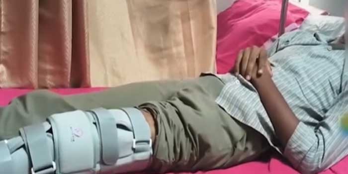 റാ​ഗിങ്ങിന് കുപ്രസിദ്ധമായ ബേക്കൂർ ഹയർ സെക്കൻഡറി സ്കൂളിൽ പ്ലസ് വൺ വിദ്യാർഥികൾക്ക് നേരെ ക്രൂര പീഡനം!! പടിക്കെട്ടിൽ തടഞ്ഞുനിർത്തി ഒരു കുട്ടിയുടെ കൈ പിന്നിലേക്ക് തിരിച്ചൊടിച്ചു, കരണത്ത് തല്ലി, മറ്റൊരു കുട്ടിയുടെ കാല് ചവിട്ടിയൊടിച്ചു… 14 പ്ലസ് ടു വിദ്യാർഥികൾക്കെതിരെ കേസ്, 4 പേർക്ക് സസ്പെൻഷൻ